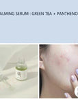 Beauty of Joseon - Calming Serum Green Tea + Panthenol, 30 ml